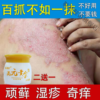 湿l疹止痒去l根皮康王百草皮肤l瘙痒l癣膏l箹正榀阴囊大腿内侧