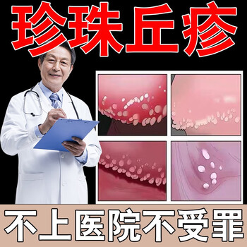 珍珠疹丘去除非药男性珍珠冠状沟处珍珠粒疹专用丘尖锐湿疣痒膏买②送