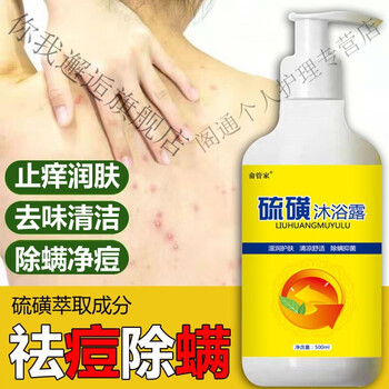 去后背痘痘除螨虫神器去身上背后背上胸前胸口背部挠印硫磺沐浴露硫磺