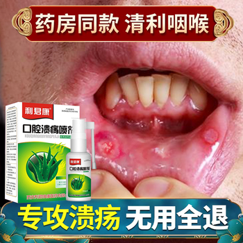 利君康口腔溃疡喷剂舌头起泡嘴巴上火牙周咽喉红肿肿痛抑喷雾 口腔溃疡喷剂x1盒