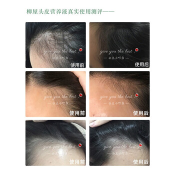 【药房直发】YANAGIYA柳屋增发清爽滋养液防脱发育发240ml营养生发液薄荷香型