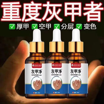 甲净无痛去灰指甲脚趾指甲增厚甲抑菌亮甲液特效通用凹凸浑浊厚 升级款【严重灰甲/不再犯】
