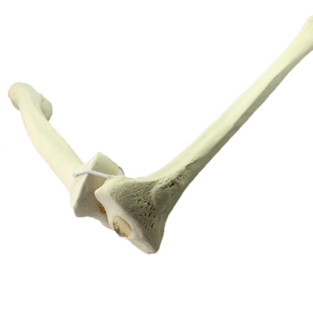 颐诺(enovo medical model) 骨科术前人工骨模型 股骨胫骨模型骨科