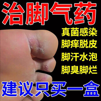 用于脚气脚臭脚痒水泡脱皮糜烂根香港脚治烂脚丫脚气用的药膏一支装
