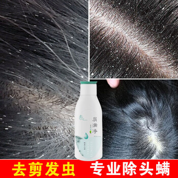 去卷发虫除吃发虫儿童去屑止痒断发抗真菌除螨虫剪发虫洗发水110ml一