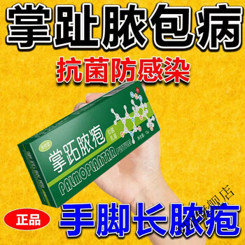 承仲堂掌跖脓疱病掌趾脓疱病手足干裂脱皮手足起脓疱手掌脓疱 10贈10