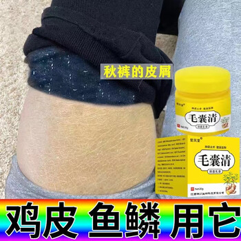 去鸡皮肤有效的药膏链接(网上买的去鸡皮肤的药膏管用吗?)