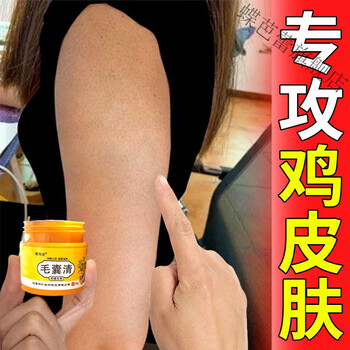 关于狐臭鸡皮肤鱼鳞腿怎么办的信息 关于狐臭鸡皮肤鱼鳞腿怎么办的信息