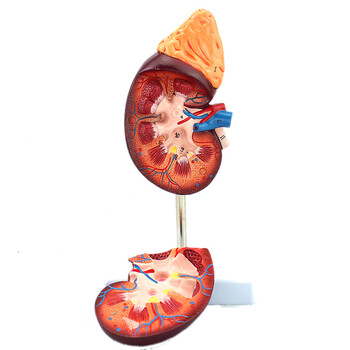 医学人体肾脏解剖模型肾模型医学泌尿科解剖用模型透析学肾内科肾脏