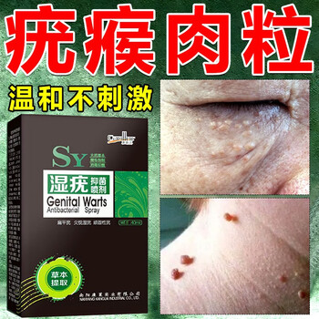 扁平疣专用膏去面部脖子丝状疣寻常疣瘊净尖锐湿疣喷剂5盒装买3松2