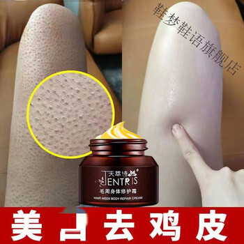 蛇皮肤和鸡皮腿图片对比(大腿的皮肤像蛇皮一样的图片) 蛇皮肤和鸡皮腿图片对比(大腿的皮肤像蛇皮一样的图片)