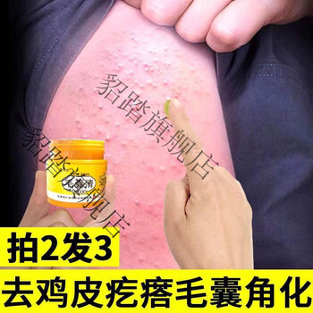 有效去鸡皮疙瘩推荐吗(有什么方法可以去鸡皮疙瘩) 有效去鸡皮疙瘩推荐吗(有什么方法可以去鸡皮疙瘩)