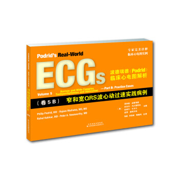 临床心电图解析卷5b窄和宽qrs波心动过速实践病例kindle电子书下载