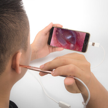 可视采耳内窥镜高清 掏耳朵神器 可视掏耳神器可视挖耳勺发光掏耳勺