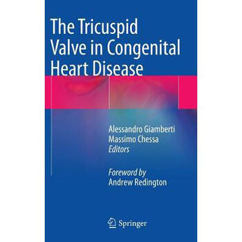the tricuspid valve in congenital heart disease