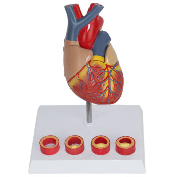 海医HeyModel 全医人体心脏模型 放大 可拆卸 带数字 心内科彩超科心血管科 1:1心脏带血栓02720