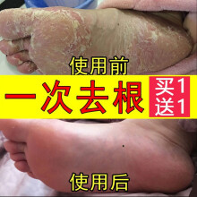 【京东旗舰店，买一送一】云南中药脚气膏 20g