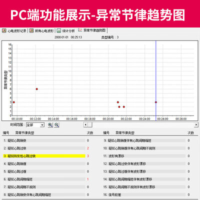 力康PC-80B心电仪究竟怎么样？抢先体验！