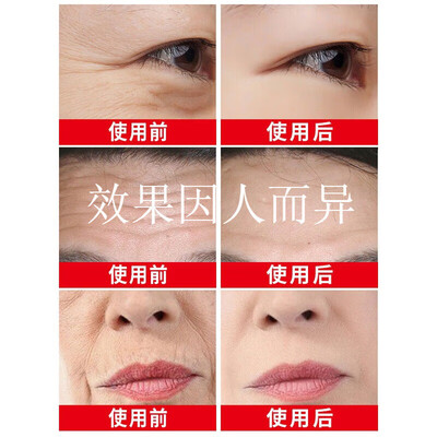 形象美贵妇素颜六件套怎么样(形象美六胜肽面膜30片抗皱补水男士面膜好不好)