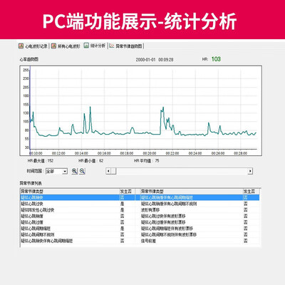 乐普PC-80B心电仪好不好，笔者细说五大亮点！