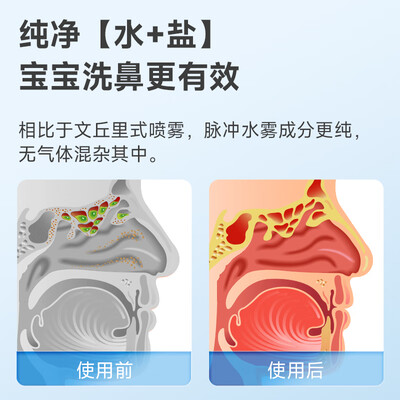 九安洗鼻器值得购买吗?一起来看看它到底怎么样!