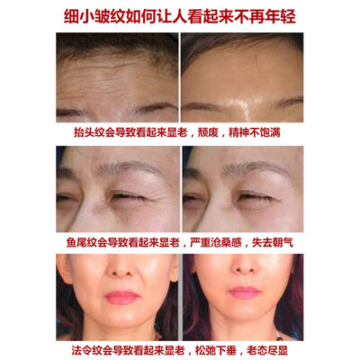 形象美贵妇素颜六件套怎么样(形象美六胜肽面膜30片抗皱补水男士面膜好不好)