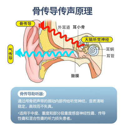 纽维达BN-803助听器评测说真相（纽维达助听器质量怎么样）