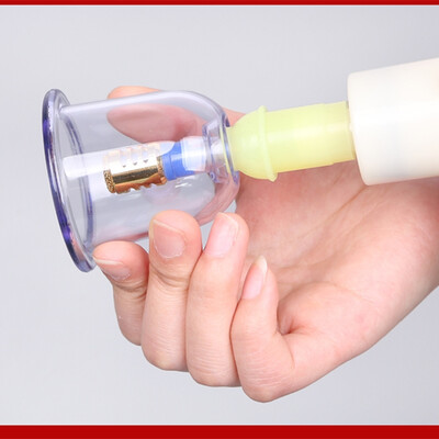 医者意GYY-I型拔罐器靠谱吗？整体表现如何？评测告诉大家真相