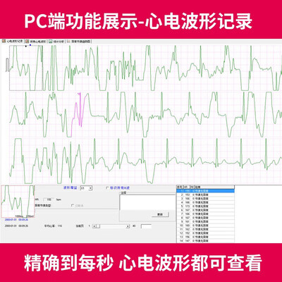 乐普PC-80B心电仪好不好，笔者细说五大亮点！