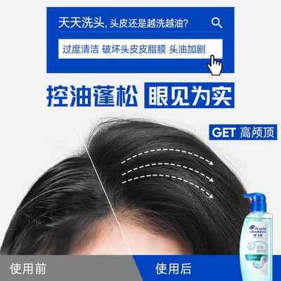 海飞丝绿瓶洗发水控油蓬松值得手入吗（海飞丝洗发水哪款好用）-图片1
