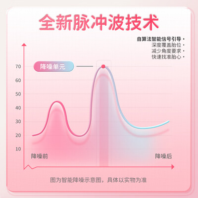 康华生物胎心仪怎么样（康华生物胎心仪评测说真相）