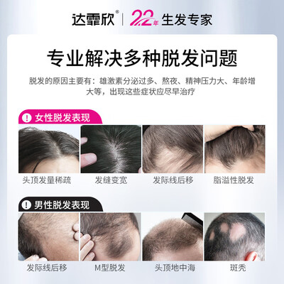 达霏欣和米诺地尔哪个好（达霏欣米诺地尔生发液60ml洗发水靠谱吗,揭秘内幕）-图片3