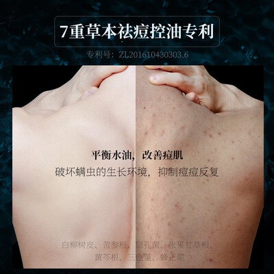 和风雨星河沐浴露真的能美白吗(和风雨星河鎏金男士沐浴洗发套装控油止痒男士沐浴露值得手入吗)-图片4