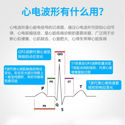 力康家用心电图仪深度测评：守护心脏健康的得力助手-图片5