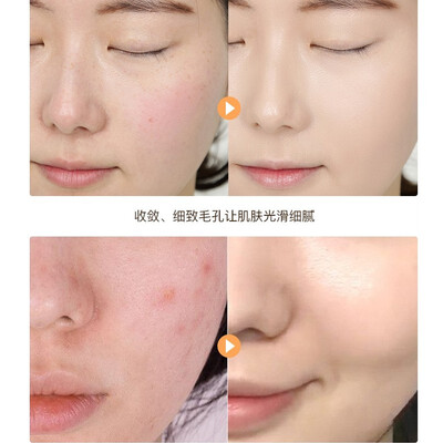 形象美玻尿酸原液怎么样（形象美玻尿酸面膜20片补水补水面膜评测说真相）-图片2
