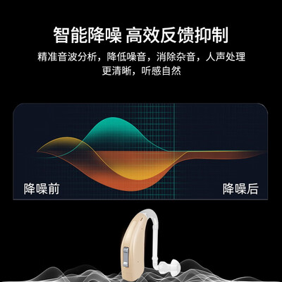 奥德声西门子奥德声助听器到底如何？10大选择理由让你心动！