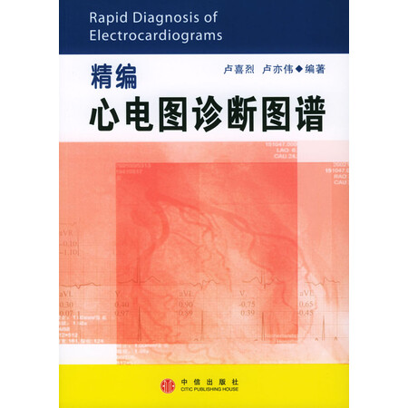【二手旧书9成新】精编心电图诊断图谱 卢喜烈,卢亦伟著