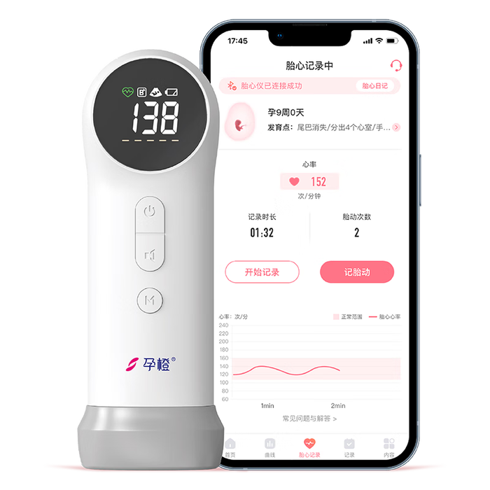 胎心仪品牌排行前十名：这10款精准监测、使用方便，守护宝宝健康的最佳选择-图片9