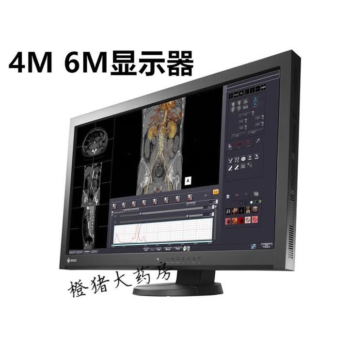 通用灰阶医用显示器艺卓EIZO 4M6M艺卓O MX270W 门子富士通用27寸彩色 6M巴可 BARCO MDCC6130 套餐一【图片 ...