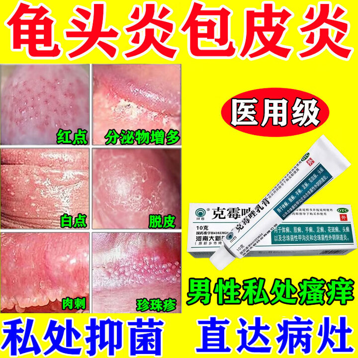 龟头炎专用药珍珠疹专用药去除龟头小肉粒龟头炎特效膏药龟头真菌感染红肿包皮炎症珍珠疹白垢红肿克霉唑乳膏 一盒【轻度龟头炎药】【图片 价格 品牌 ...
