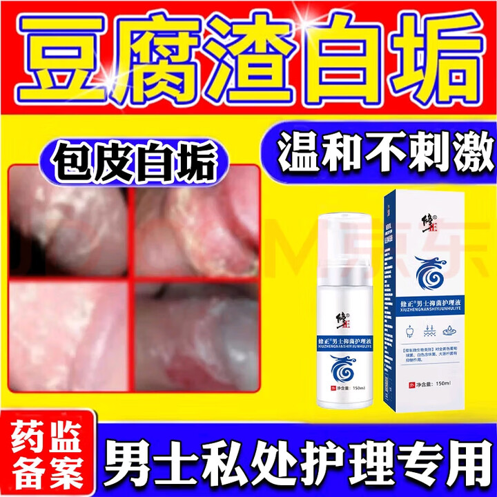 修正包皮白垢豆腐渣专用的药清洗液包皮炎藏白色污垢龟头炎男士专用 单盒装【图片 价格 品牌 报价】-京东