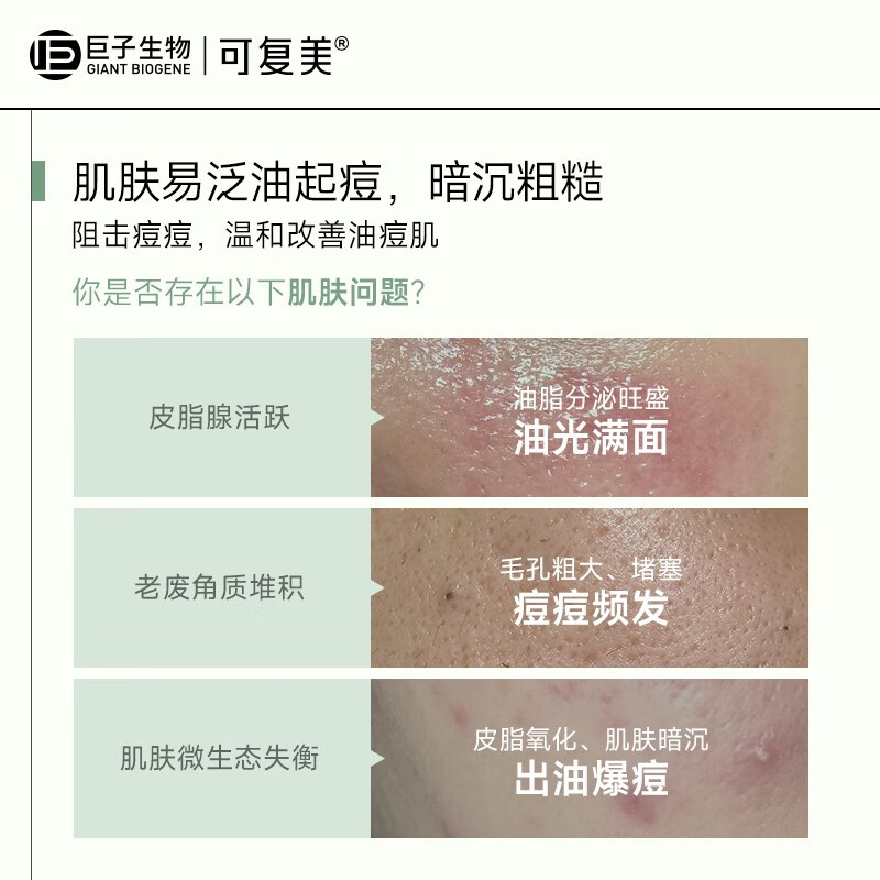 可复美秩序水 稀有人参皂苷致研净痘控油精华水 祛痘保湿控油去角质 秩序水150ml+秩序乳80ml