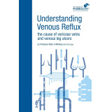【按需印刷】Understanding Venous Reflux the Cause of Varicose Veins and Venous Leg Ulcers