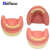 TWTCKYUS上颌窦提升操练模型 种植牙练习模型 口腔种植 软牙龈 齿科材料 下河种植模型1个