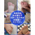 婴儿童脚趾头小孩大拇指外翻器宝宝重叠分离器分趾大母指内扣 婴儿款(4个月-18个月)