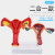 人体女性生殖子宫解剖病理模型卵巢教学模型 妇科生殖科教具 精品款 病理+卵巢(二合一) 送图纸
