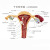 人体女性生殖子宫解剖病理模型卵巢教学模型 妇科生殖科教具 精品款 正常+病理(二合一) +图纸