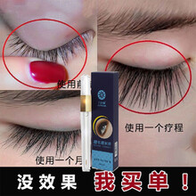 【用完不长包退】九叶草睫毛增长液睫毛膏眉毛生长液浓密纤长滋养男女自然生长 2瓶装【纤长浓密，自然生长】