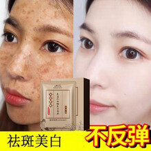 【现货秒发】美白面膜祛斑男女补水保湿控油美白去黄改善皮肤干燥粗糙蚕丝面膜提亮肤色面膜 两盒装【清斑美白蚕丝面膜】