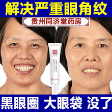 【同济堂药房】眼霜去细纹祛眼袋去黑眼圈抗皱眼霜二裂酵母淡化细纹提拉紧致去脂肪粒男女通用 一支20g【三支周期效果佳】